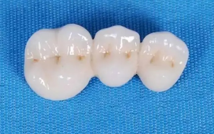 Zirconium oxide teeth